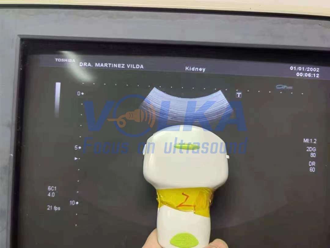 Toshiba PVU-375BT 6.0MHz Convex Array Ultrasound Transducer Probe Hospital Imaging System