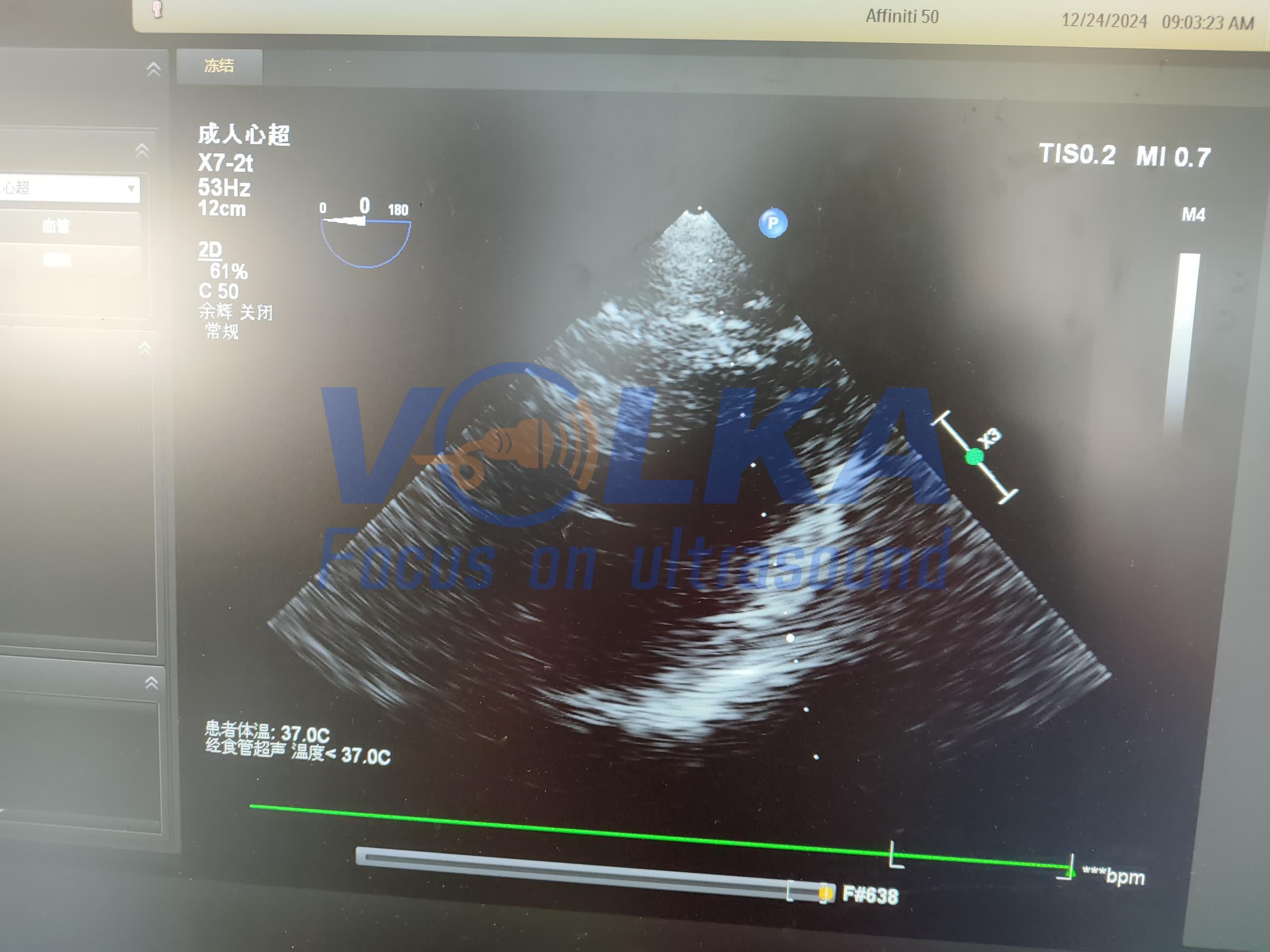 Philips CX50 TEE original ultrasound probe X7-2T xMatrix Array