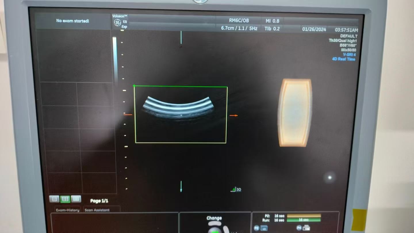 Repair GE Voluson E10 convex 3D/4D OB/GYN Probe RM6C Motor control problem