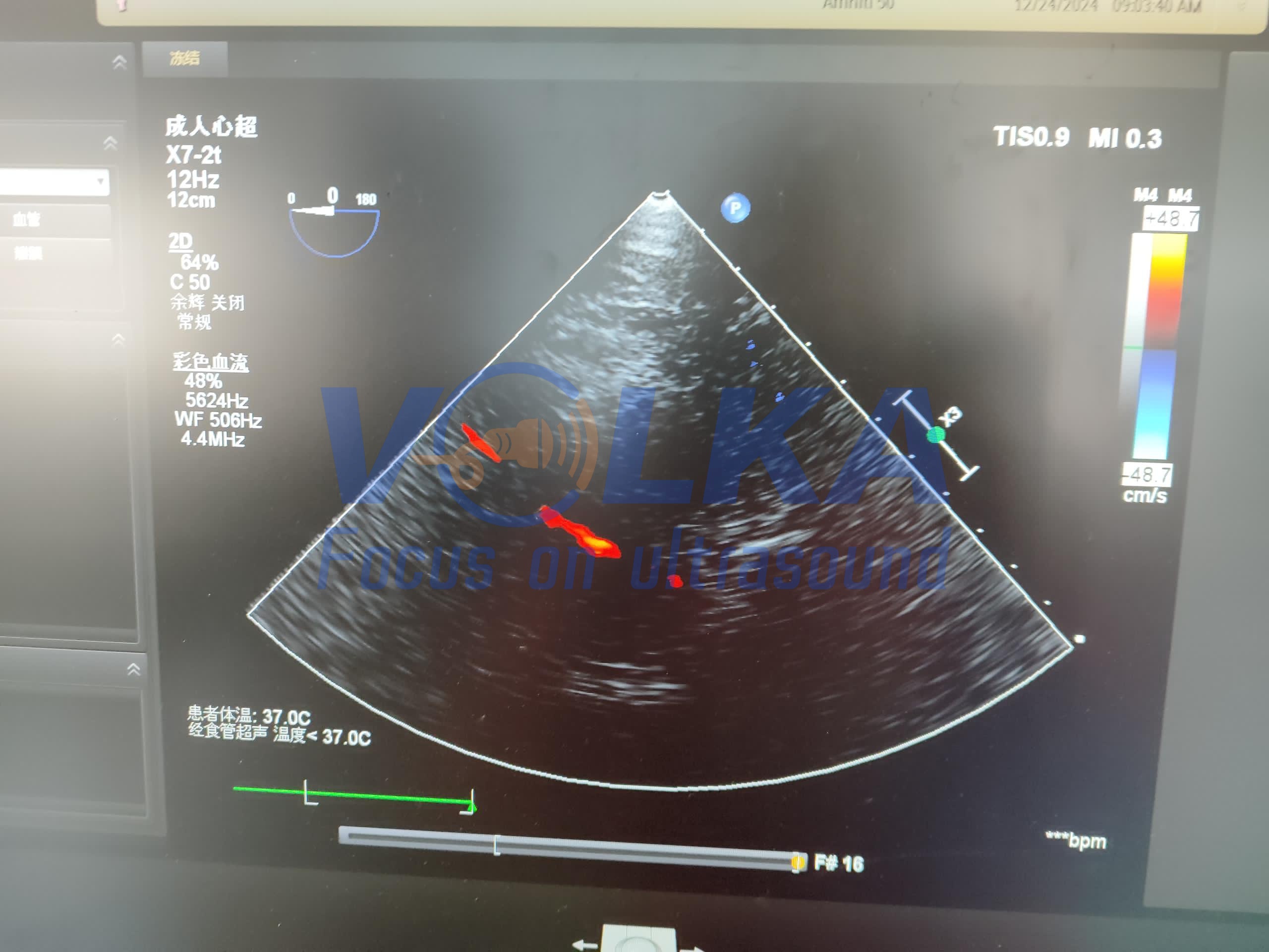 Philips CX50 TEE original ultrasound probe X7-2T xMatrix Array