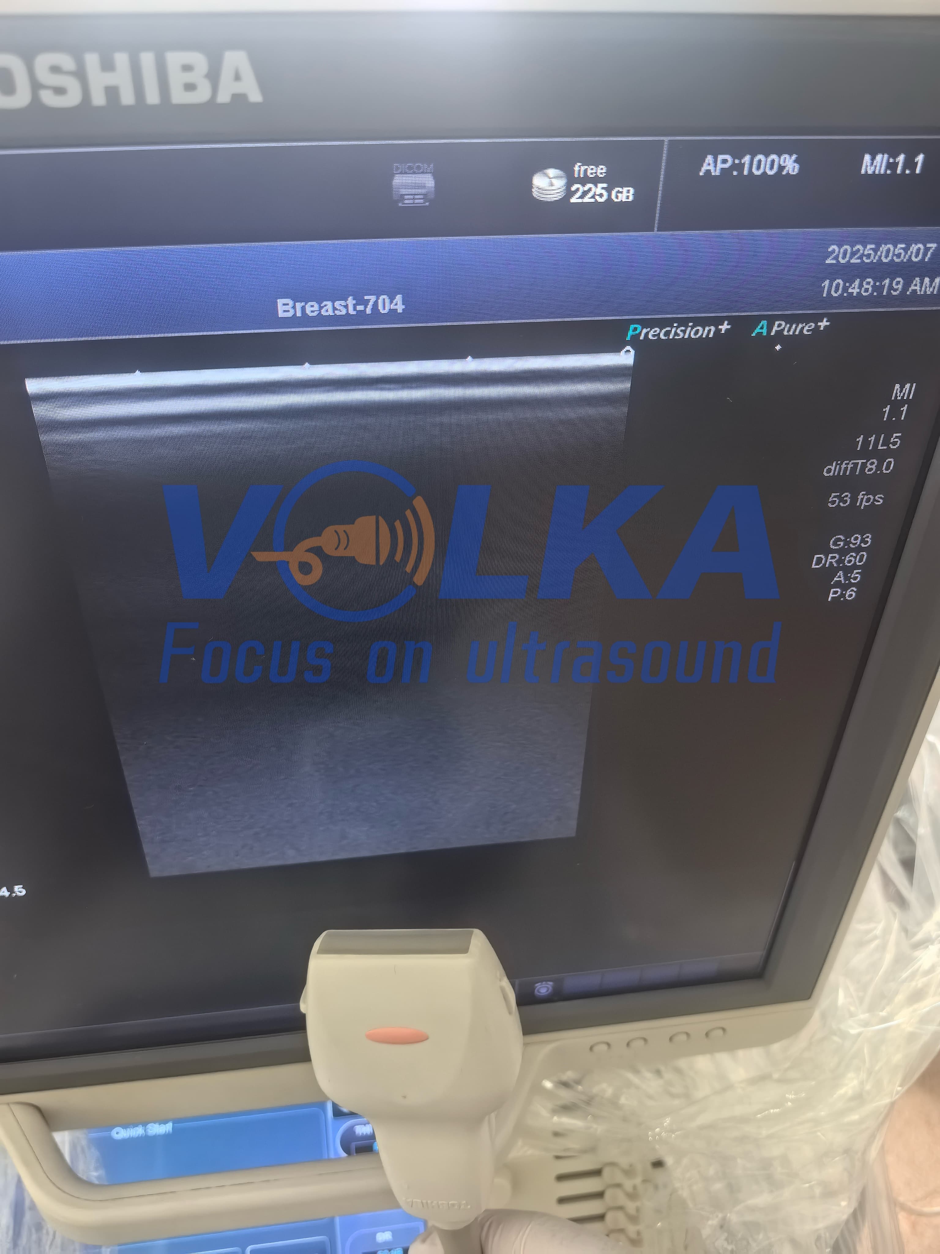 Canon Toshiba Aplio 50 SSA-700A Linear Vascular ultrasound probe PLT-704AT