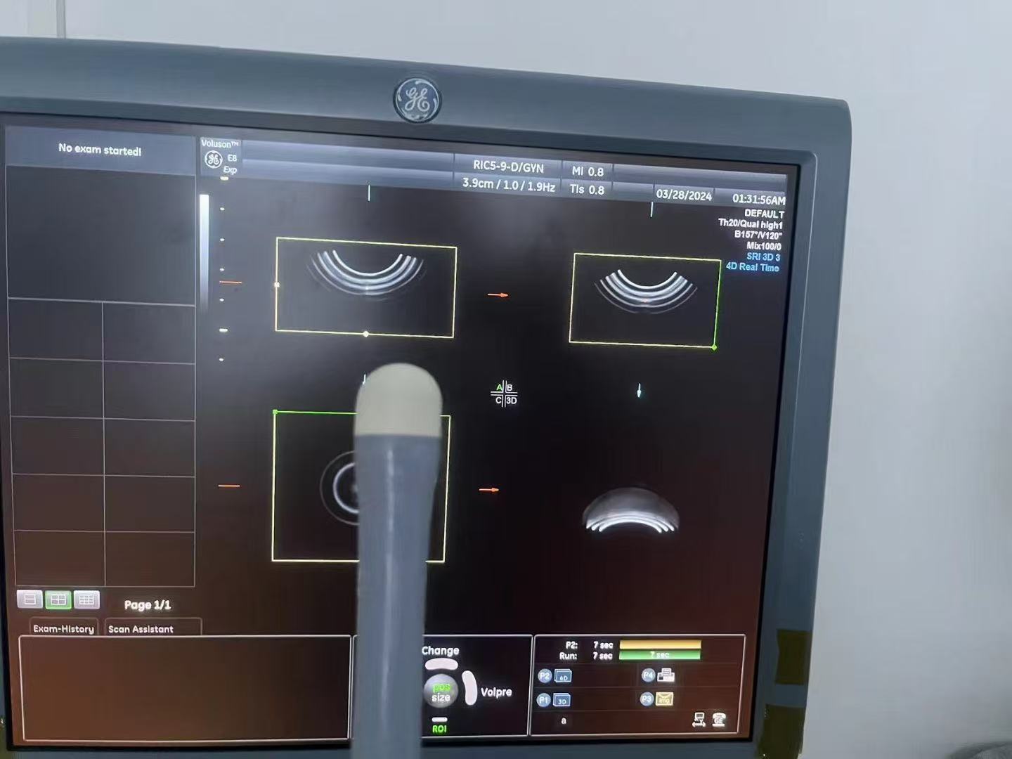 Repair GE Logiq E9 Endocavitary 3D/4D OB/GYN Probe RIC5-9-D