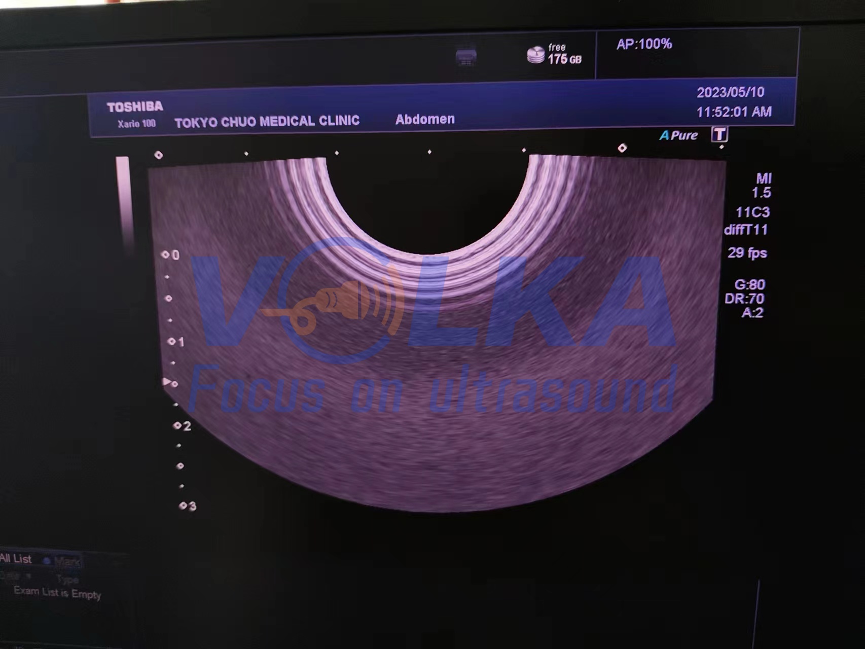 Toshiba PVU-781VT Endocavity Ultrasound Transducer Probe Image Digital