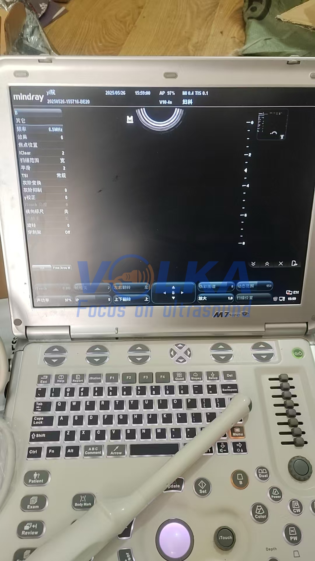 Mindray M7 portable ultrasound machine