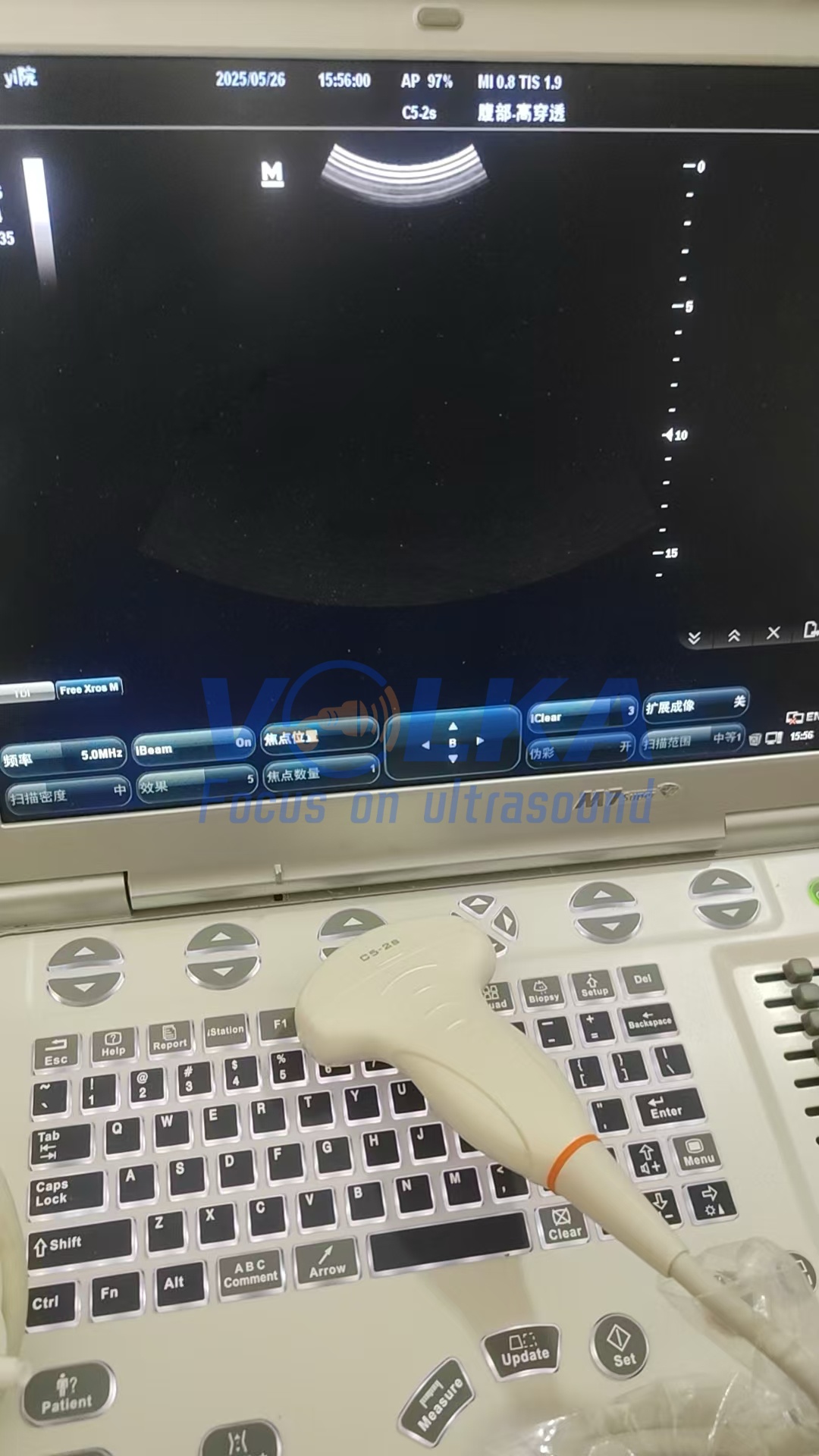 Mindray M7 portable ultrasound machine